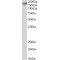 Calcium Channel, Voltage Dependent, L-Type, Alpha 1C Subunit (CACNA1C) Antibody