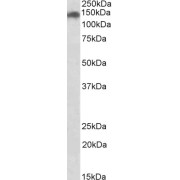 abx432441 (0.2 µg/ml) staining of HeLa lysate (35 µg protein in RIPA buffer). Primary incubation was 1 hour. Detected by chemiluminescence.