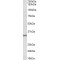 Caspase 6 (CASP6) Antibody