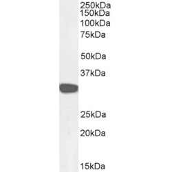 Carbonyl Reductase 1 (CBR1) Antibody