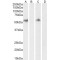 Cluster Of Differentiation 14 (CD14) Antibody