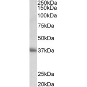 abx432478 (0.5 µg/ml) staining of Human Thymus lysate (35 µg protein in RIPA buffer). Primary incubation was 1 hour. Detected by chemiluminescence.