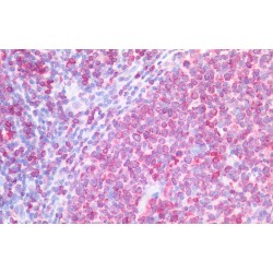 HLA Class II Histocompatibility Antigen Gamma Chain (CD74) Antibody