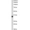 HLA Class II Histocompatibility Antigen Gamma Chain (CD74) Antibody