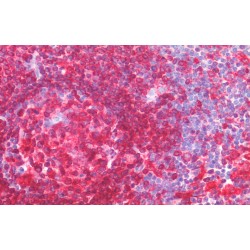 HLA Class II Histocompatibility Antigen Gamma Chain (CD74) Antibody