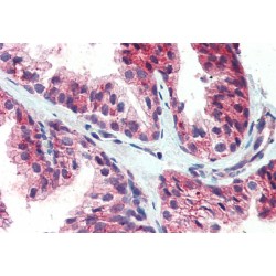 CDCP1 (Isoform 1) Antibody