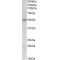 Corneodesmosin (CDSN) Antibody