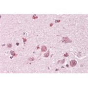 abx432502 (3.8 µg/ml staining of paraffin embedded Human Cortex. Steamed antigen retrieval with citrate buffer pH 6, AP-staining.