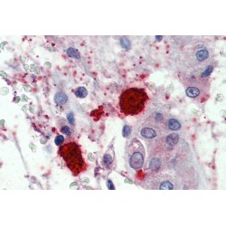 Chymase 1, Mast Cell (CMA1) Antibody