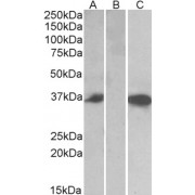 HEK293 lysate (10 µg protein in RIPA buffer) over expressing Human CMA1 with DYKDDDDK tag probed with abx432519 (0.5 µg/ml) in Lane A and probed with anti- DYKDDDDK Tag (1/3000) in lane C. Mock-transfected HEK293 probed with abx432519 (1mg/ml) in Lane B. Primary incubations were for 1 hour. Detected by chemiluminescence.
