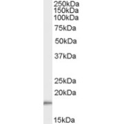 abx432538 (0.01 µg/ml) staining of human muscle lysate (35 µg protein in RIPA buffer). Primary incubation was 1 hour. Detected by chemiluminescence.