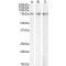 Carnitine Palmitoyltransferase 2, Mitochondrial (CPT2) Antibody