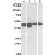 abx432548 (0.01 µg/ml) staining of Human (A, C) and Mouse (B, D) Skeletal Muscle (A, B) and Heart (C, D) lysates (35 µg protein in RIPA buffer). Primary incubation was 1 hour. Detected by chemiluminescence.