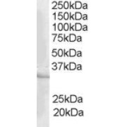 abx432551 staining (1 µg/ml) of Human Heart lysate (RIPA buffer, 35 µg total protein per lane). Primary incubated for 1 hour. Detected by chemiluminescence.