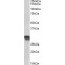 cyclin D1 (CCND1) Antibody