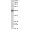 Cytochrome P450 24A1 (CYP24A1) Antibody