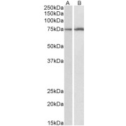 abx432570 (0.1 µg/ml) staining of HepG2 (A) and K562 (B) lysates (35 µg protein in RIPA buffer). Primary incubation was 1 hour. Detected by chemiluminescence.