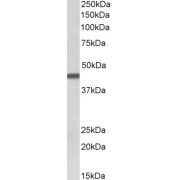 abx432580 (0.1 µg/ml) staining of Human Breast cancer lysate (35 µg protein in RIPA buffer). Primary incubation was 1 hour. Detected by chemiluminescence.