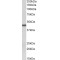 Keratin 19 (KRT19) Antibody