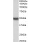 Cytokeratin 20 (CK20) Antibody