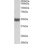 abx432584 (0.03 µg/ml) staining of Human Colon lysate (35 µg protein in RIPA buffer). Primary incubation was 1 hour. Detected by chemiluminescence.