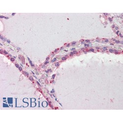 Death-Associated Protein Kinase 2 (DAPK2) Antibody