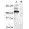 Doublecortin Domain-Containing Protein 2 (DCDC2) Antibody