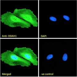 Dimethylarginine Dimethylaminohydrolase 1 (DDAH1) Antibody