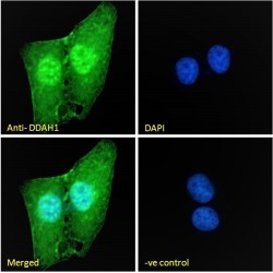 Dimethylarginine Dimethylaminohydrolase 1 (DDAH1) Antibody