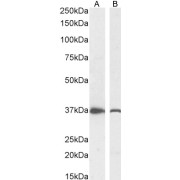 abx432595 (0.3 µg/ml) staining of HepG2 (A) and LNCaP (B) cell lysate (35 µg protein in RIPA buffer). Detected by chemiluminescence.