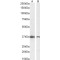 Dimethylarginine Dimethylaminohydrolase 1 (DDAH1) Antibody