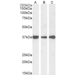 Dimethylarginine Dimethylaminohydrolase 1 (DDAH1) Antibody