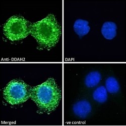 Dimethylarginine Dimethylaminohydrolase 2 (DDAH2) Antibody