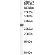 abx432596 (0.1 µg/ml) staining of Human Lung lysate (35 µg protein in RIPA buffer). Detected by chemiluminescence.