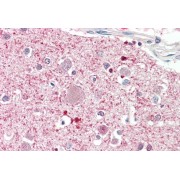 abx432602 (5 µg/ml staining of paraffin embedded Human Cortex. Steamed antigen retrieval with citrate buffer pH 6, AP-staining.