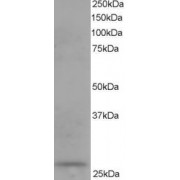 abx432604 staining (0.1 µg/ml) of human kidney lysate (RIPA buffer, 35 µg total protein per lane). Primary incubated for 1 hour. Detected by western blot using chemiluminescence.