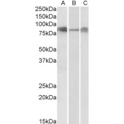 abx432612 (0.3 µg/ml) staining of Human (A), Mouse (B) and Rat (C) Lung lysates (35 µg protein in RIPA buffer). Detected by chemiluminescence