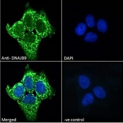 Microvascular Endothelial Differentiation Gene 1 Protein (DNAJB9) Antibody