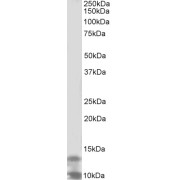 abx432621 (2 µg/ml) staining of K562 lysate (35 µg protein in RIPA buffer). Primary incubation was 1 hour. Detected by chemiluminescence.