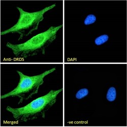 Dopamine Receptor D5 (DRD5) Antibody