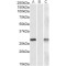 DPY30 Domain-Containing Protein 1 (DYDC1) Antibody