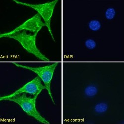 Early Endosome Antigen 1 (EEA1) Antibody