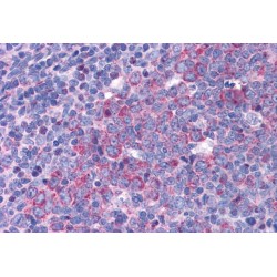 Eukaryotic Translation Initiation Factor 5A-1 (eIF5A) Antibody