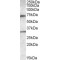 Lipase, Endothelial (LIPG) Antibody