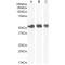 Equilibrative Nucleoside Transporter 1 (ENT1) Antibody