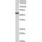 Epoxide Hydrolase 2, Cytoplasmic (EPHX2) Antibody