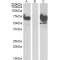 EPM2A (Laforin) Interacting Protein 1 (EPM2AIP1) Antibody