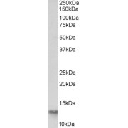 abx432671 (0.03 µg/ml) staining of Human Adipose lysate (35 µg protein in RIPA buffer). Primary incubation was 1 hour. Detected by chemiluminescence.