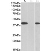 HEK293 lysate (10 µg protein in RIPA buffer) overexpressing Human FANCF with C-terminal MYC tag probed withabx432674 (0.5 µg/ml) in Lane A and probed with anti-MYC Tag (1/1000) in lane C. Mock-transfected HEK293 probed wih abx432674 (1mg/ml) in Lane B. Primary incubations were for 1 hour. Detected by chemiluminescence.