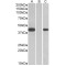 Fanconi Anemia Complementation Group F (FANCF) Antibody